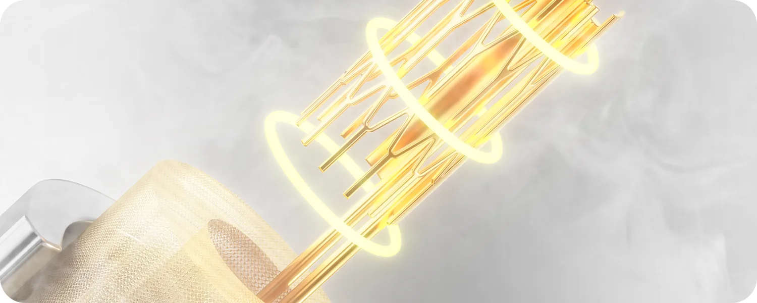 Mesh coil diagram